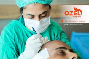 ماهو 3 افضل مراكز زراعة الشعر في تركيا عام 2023